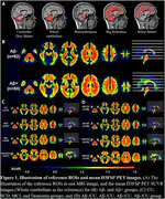 [18F]-D3FSP amyloid-β PET imaging in elderly adults and Alzheimer’s disease