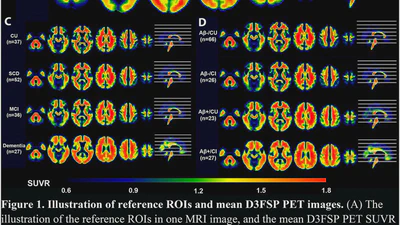 [18F]-D3FSP amyloid-β PET imaging in elderly adults and Alzheimer’s disease featured image