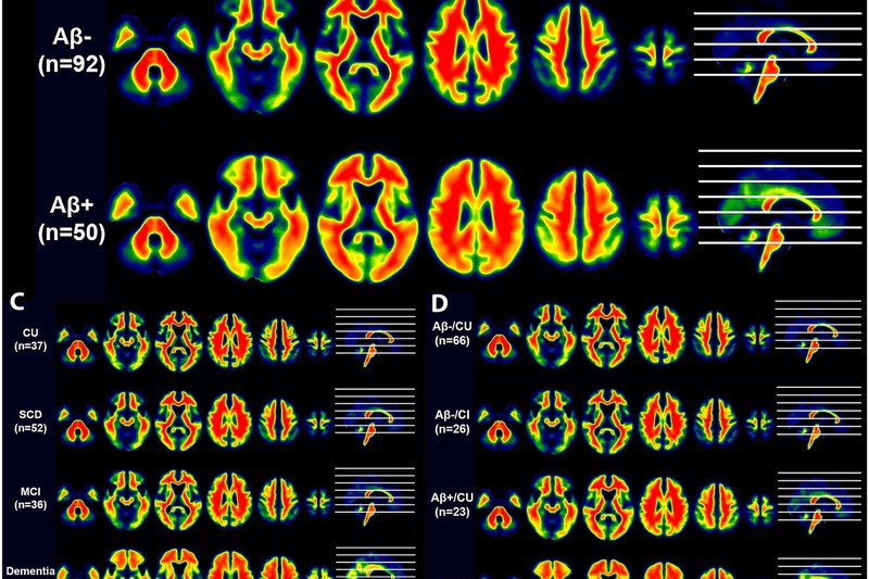 [18F]-D3FSP amyloid-β PET imaging in elderly adults and Alzheimer’s disease