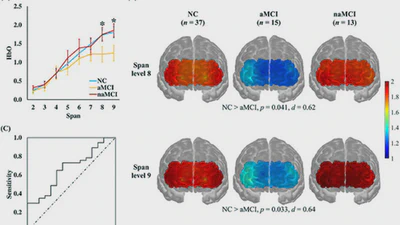 fNIRS as a biomarker for individuals with subjective memory complaints and MCI featured image